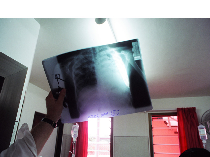 kantha bopha kinderspital siem reap